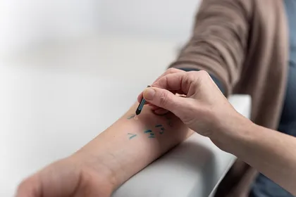 Behandlung Allergietest